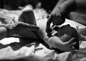 birth injury 1