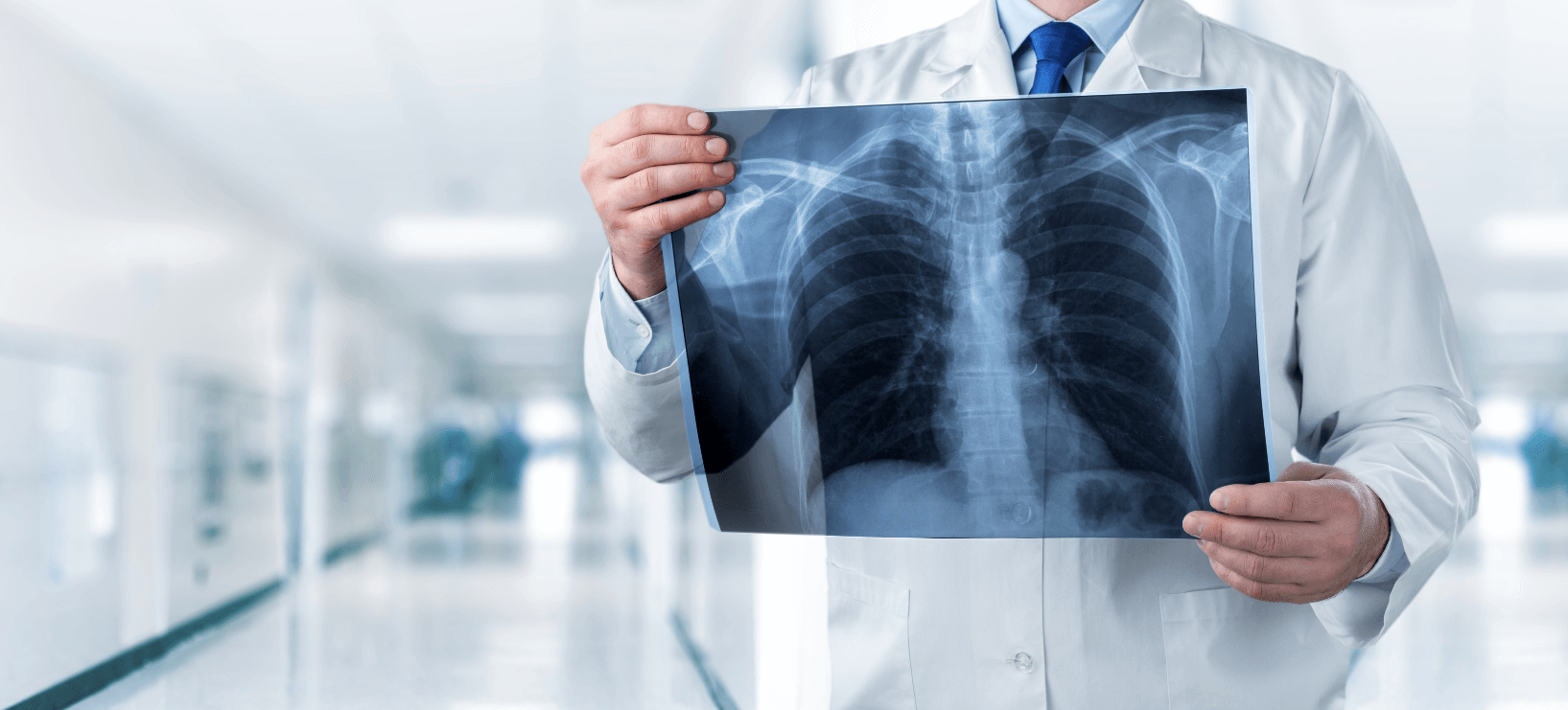 Misread X Ray Malpractice PA