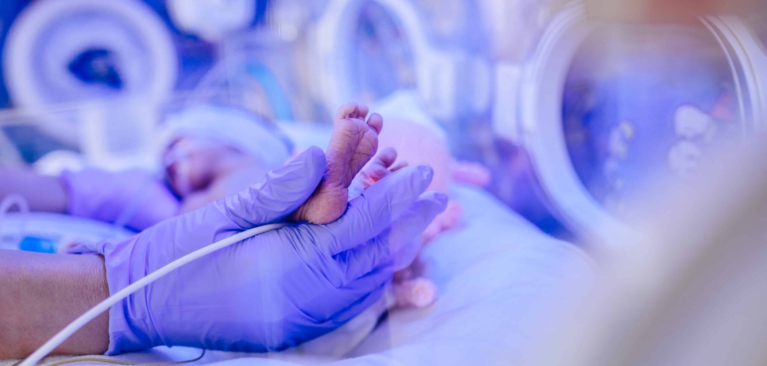 premature baby in pod with bilirubin light